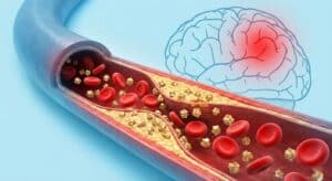 הקשר בין סוכר לכלי דם